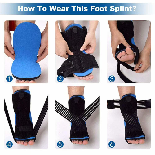 Ночная шина от подошвенного фасциита